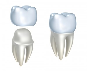 dental-crowns